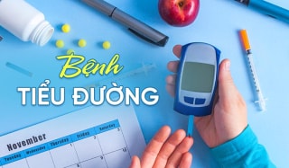 Chai 1000ml Nước Cốt Nhàu Nano X (Có đường)